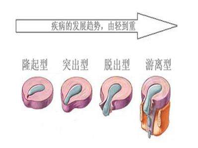 173ce991cb504da5924a4a8e4bf4c9ef_th