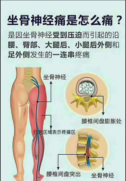 ba119e6ecb2e9c45479cb5ddc48c5f7